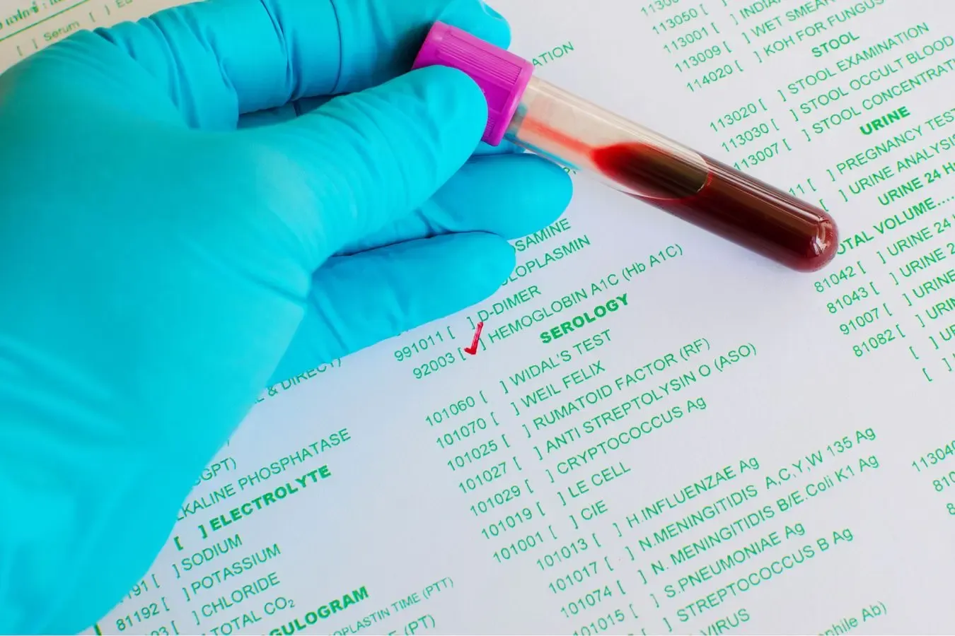 best way to lower a1c